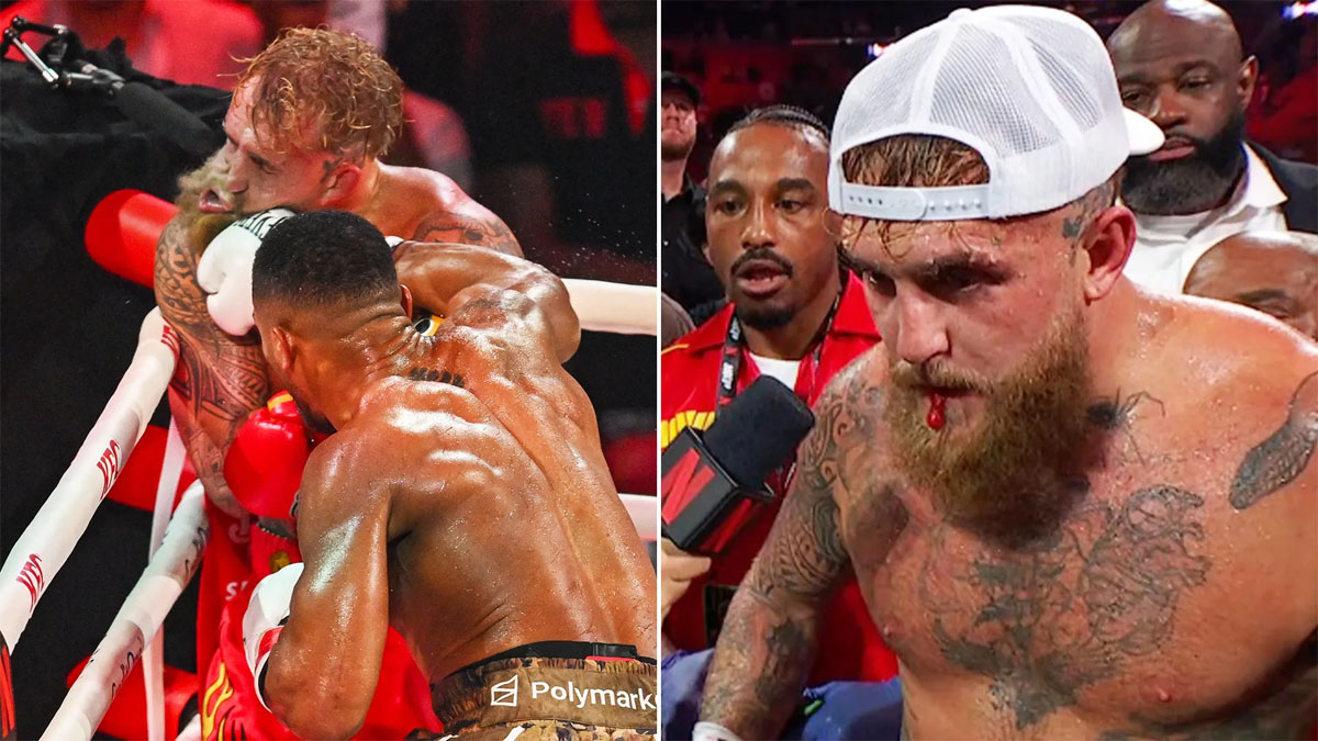 Jake Paul Hospitalised With Suspected Broken Jaw After Knockout Loss to Anthony Joshua