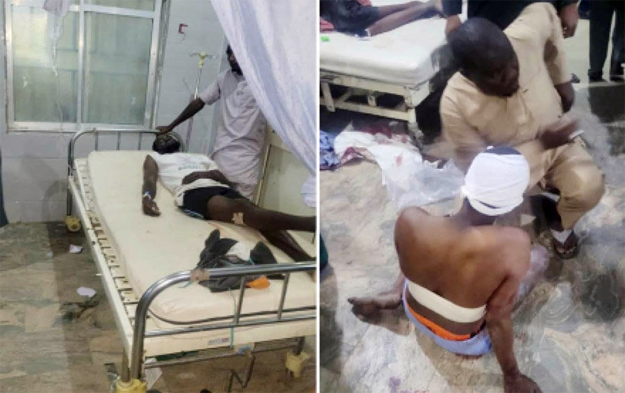 Victims of the bomb blast receiving treatment at the Umaru Shehu Hospital, Maiduguri, Borno State yesterday