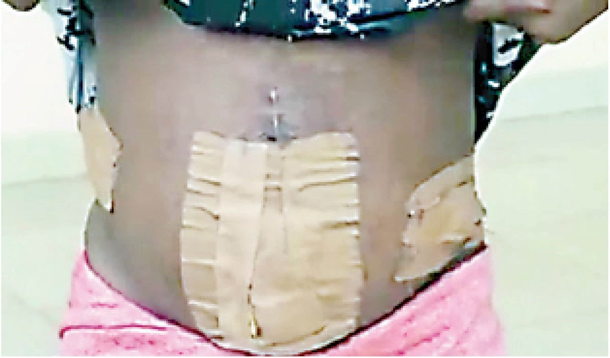 Human Traffickers Remove Teenager's Womb to Punish Her for Rejecting Sex Work