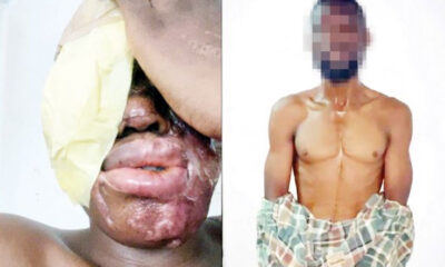 The victim and the apprehended suspect, Zakari