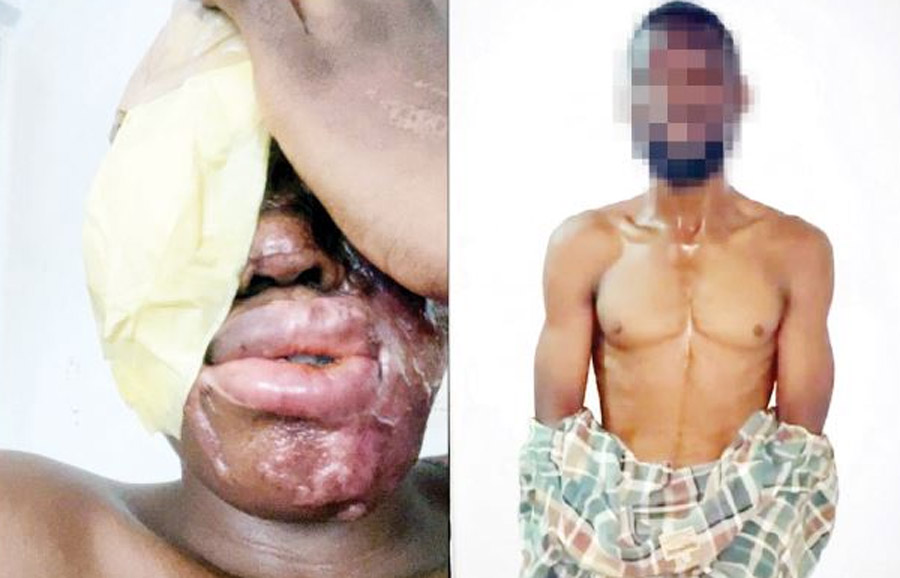The victim and the apprehended suspect, Zakari