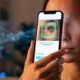 AI Smartphone App Detects Eye Cancer with Near-Specialist Accuracy, Study Finds