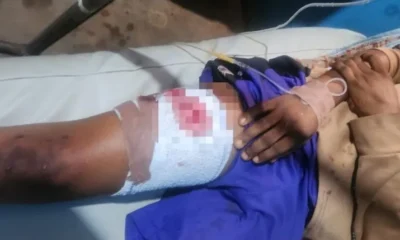 12-Year-Old Boy Shot During APC Campaign Rally in Ilesa, Protests Erupt in Osun