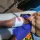 12-Year-Old Boy Shot During APC Campaign Rally in Ilesa, Protests Erupt in Osun