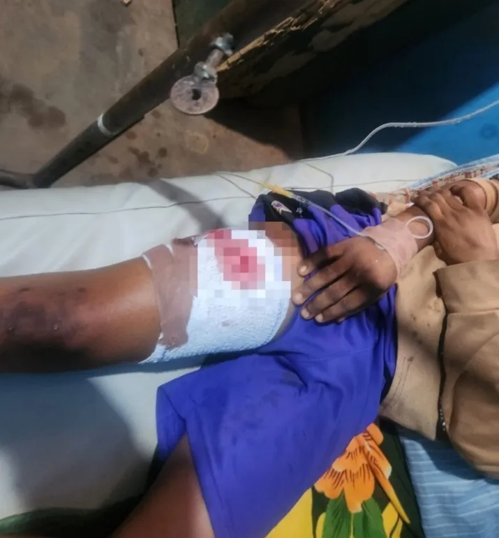 12-Year-Old Boy Shot During APC Campaign Rally in Ilesa, Protests Erupt in Osun