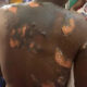 Police to prosecute Kogi man for allegedly setting wife ablaze