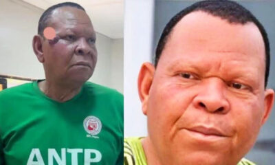 ANTP Debunks Cancer Rumors as Actor Wale Elesho Undergoes Successful Facial Surgery