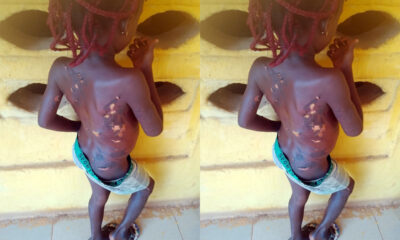 Police Arrest Mother Over Alleged Brutal Abuse of 7-Year-Old Girl in Anambra