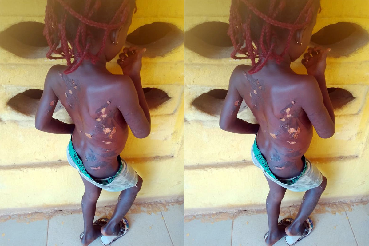 Police Arrest Mother Over Alleged Brutal Abuse of 7-Year-Old Girl in Anambra